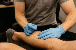 Dry Needling