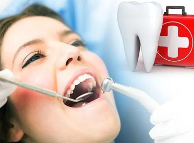 Summer Dental Tips
