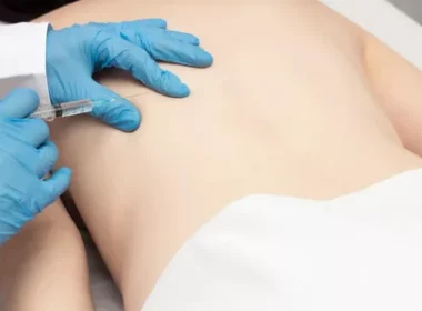 Trigger Point Injections in Manhattan