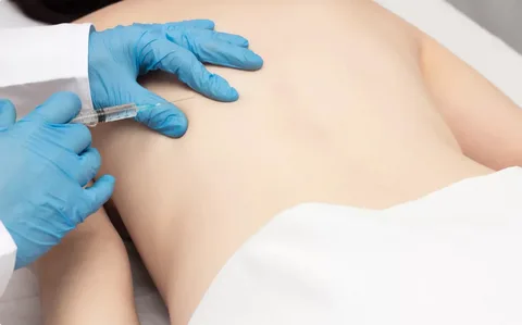 Trigger Point Injections in Manhattan