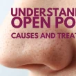 Understanding Open Pores