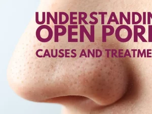 Understanding Open Pores