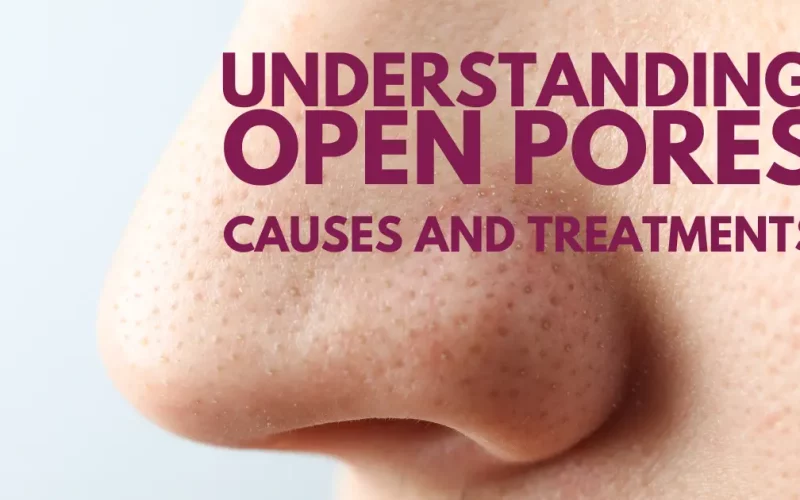 Understanding Open Pores