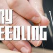 Dry Needling