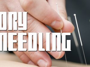 Dry Needling