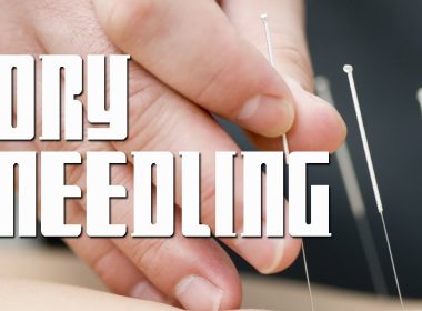 Dry Needling