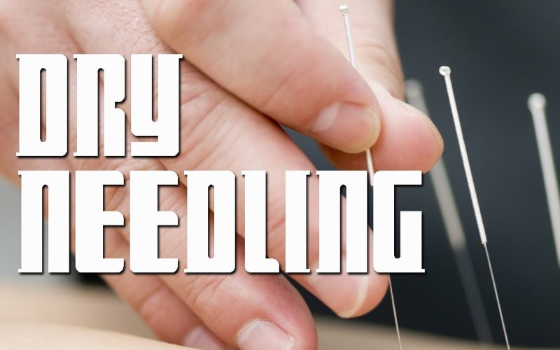 Dry Needling