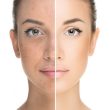 skin whitening treatment islamabad pakistan