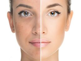 skin whitening treatment islamabad pakistan