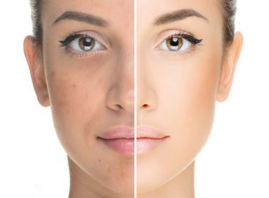 skin whitening treatment islamabad pakistan
