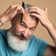 Androgenetic Alopecia