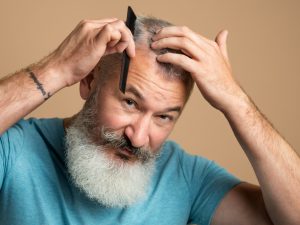 Androgenetic Alopecia