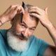 Androgenetic Alopecia