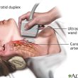 CAROTID ARTERY SCAN
