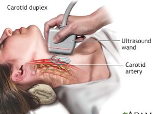 CAROTID ARTERY SCAN