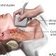 CAROTID ARTERY SCAN