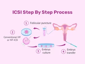 Advanced ICSI Treatment for Infertility in Delhi – Leading Clinics, Competitive Pricing, and Authentic Success Stories