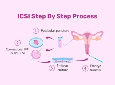 Advanced ICSI Treatment for Infertility in Delhi – Leading Clinics, Competitive Pricing, and Authentic Success Stories