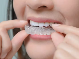invisalign in mumbai