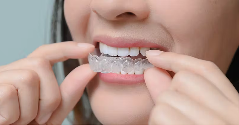 invisalign in mumbai