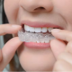 invisalign in mumbai