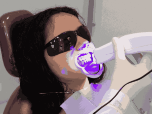 LED teeth whitening