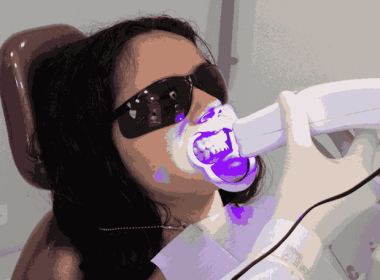 LED teeth whitening