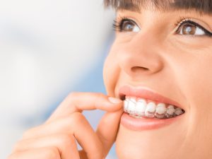 Getting Invisalign Full as an Adult