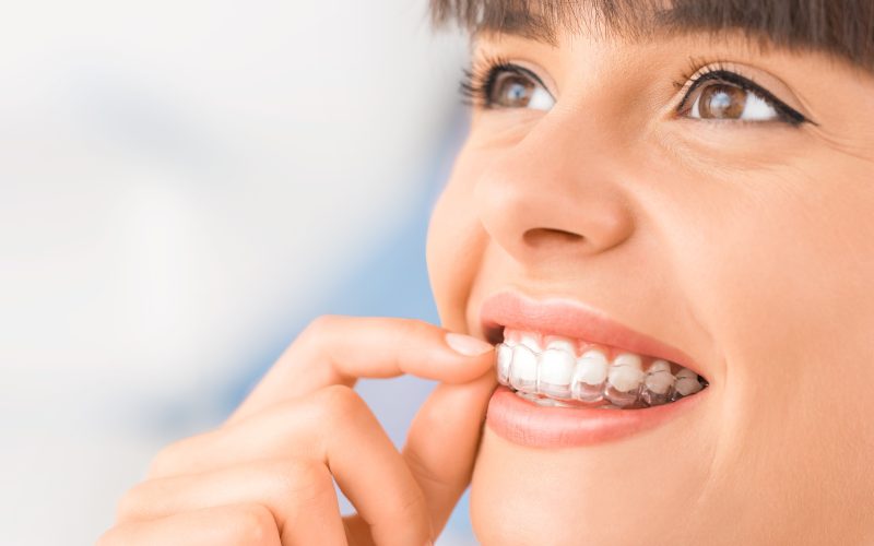 Getting Invisalign Full as an Adult