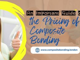 the cost of the treatment of composite bonding