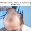 Beneficios de Acudir a Clínicas de Implante Capilar Certificadas