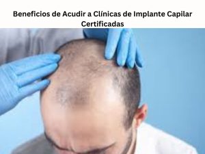 Beneficios de Acudir a Clínicas de Implante Capilar Certificadas