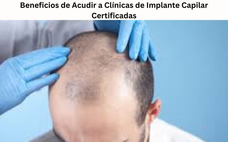 Beneficios de Acudir a Clínicas de Implante Capilar Certificadas
