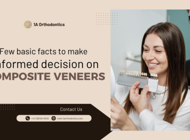 price for composite veneers in the UK