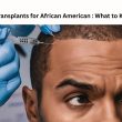Hair Transplants for African American : What to Know