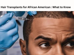 Hair Transplants for African American : What to Know