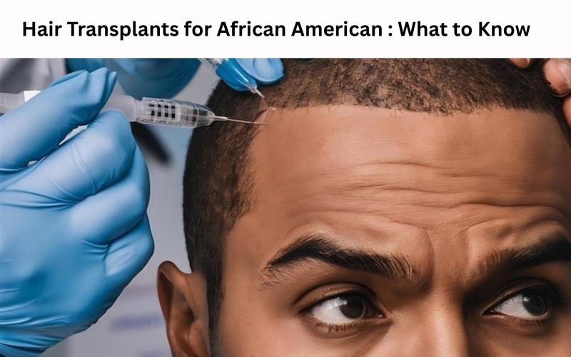 Hair Transplants for African American : What to Know