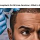 Hair Transplants for African American : What to Know