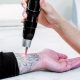 laser tattoo removal in islamabad