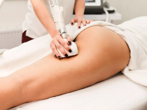 Is Laser Lipolysis Treatment Effective on Cellulite (1)