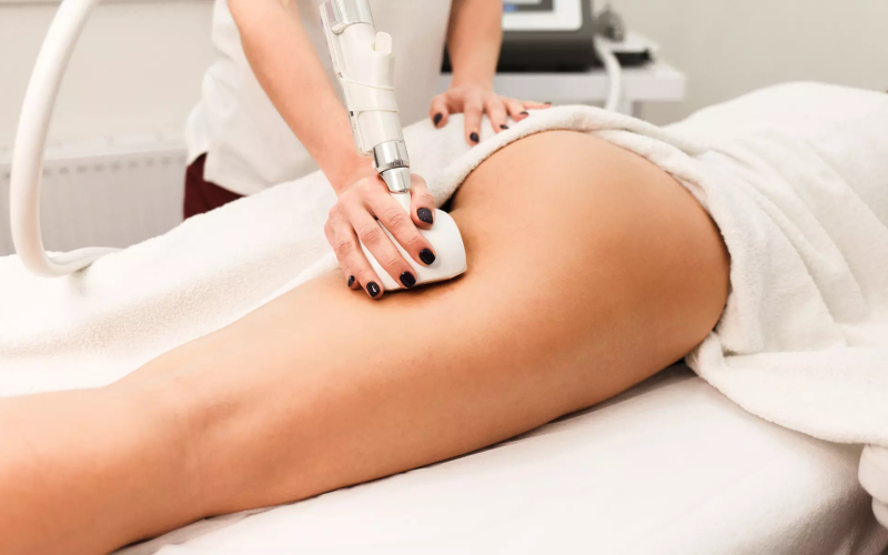 Is Laser Lipolysis Treatment Effective on Cellulite (1)