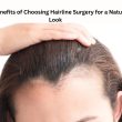 Top Benefits of Choosing Hairline Surgery for a Natural Look