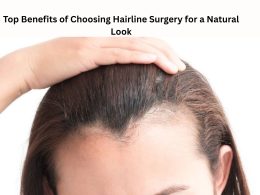 Top Benefits of Choosing Hairline Surgery for a Natural Look