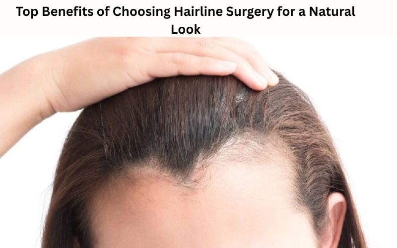 Top Benefits of Choosing Hairline Surgery for a Natural Look