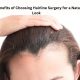 Top Benefits of Choosing Hairline Surgery for a Natural Look