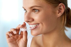 Getting Invisalign Full as an Adult