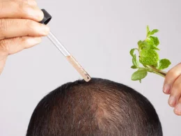 prp hair treatment in islamabad (1)