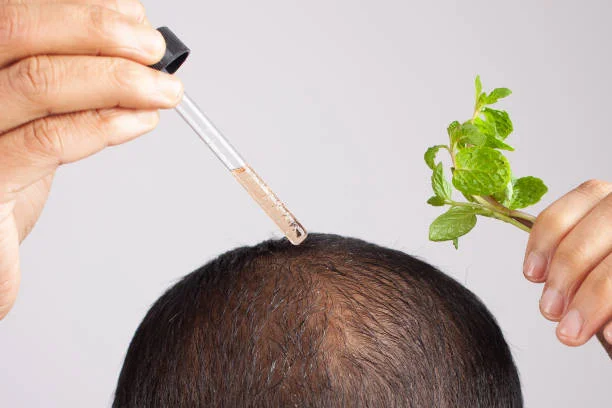 prp hair treatment in islamabad (1)