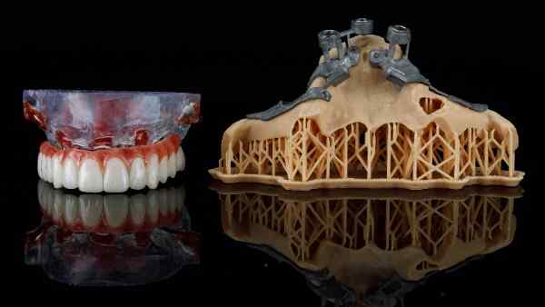 implant