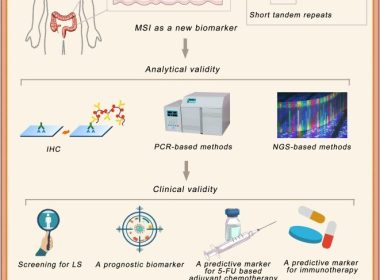 the-role-of-ngs-in-msi-detection